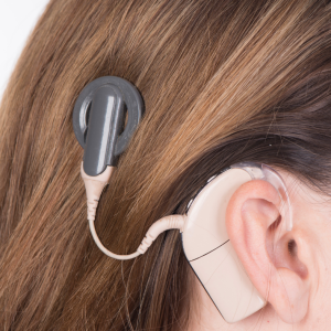 woman with hearing loss wearing a cochlear implant